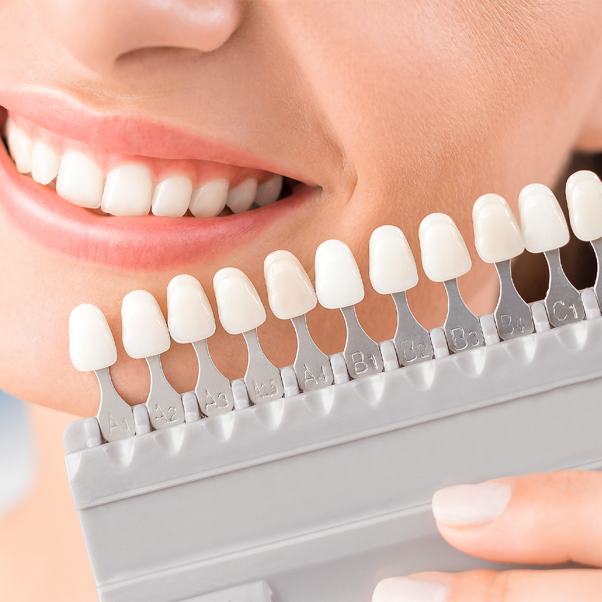 シェードガイドとは